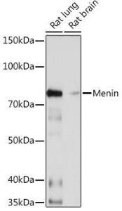 Anti-Menin Rabbit Monoclonal Antibody [clone: ARC1968]