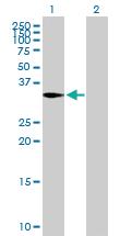 Anti-CAPZA2 Mouse Polyclonal Antibody