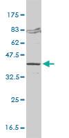 Anti-KDSR Mouse Monoclonal Antibody [clone: 2B2-3C11]