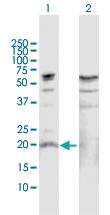 Anti-IL19 Rabbit Polyclonal Antibody