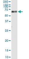 Anti-CNDP1 Polyclonal Antibody Pair