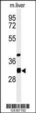 Anti-ECHDC1 Rabbit Polyclonal Antibody (PE (Phycoerythrin))