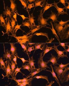 Immunofluorescence analysis of C6 cells using Anti-Caspase-3 Antibody (A93186) at a dilution of 1:100. DAPI was used to stain the cell nuclei (blue)