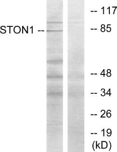 Western blot analysis of lysates from K562 cells using Anti-STON1 Antibody. The right hand lane represents a negative control, where the antibody is blocked by the immunising peptide.