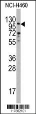 Anti-Neutrophil elastase Rabbit Polyclonal Antibody