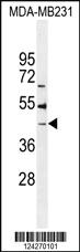 Anti-B4GALT6 Rabbit Polyclonal Antibody