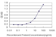 Anti-KDSR Mouse Monoclonal Antibody [clone: 2B2-3C11]