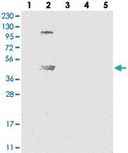 Anti-ZNF114 Rabbit Polyclonal Antibody