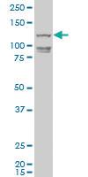 Anti-HELQ Mouse Polyclonal Antibody