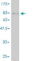 Anti-CETP Mouse Polyclonal Antibody