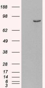 HEK293 overexpressing Human PDE4B (RC211956) and probed with Anti-PDE4B Antibody (A83461) (mock transfection in first lane), tested by Origene