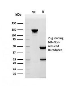 SDS-PAGE analysis of Anti-HSP90 beta Antibody [HSP90AB1/3952] under non-reduced and reduced conditions; showing intact IgG and intact heavy and light chains, respectively. SDS-PAGE analysis confirms the integrity and purity of the Antibody