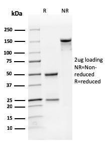 SDS-PAGE analysis of Anti-CD31 Antibody [SPM122] under non-reduced and reduced conditions; showing intact IgG and intact heavy and light chains, respectively. SDS-PAGE analysis confirms the integrity and purity of the antibody.