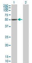 Anti-ALDH1A1 Mouse Polyclonal Antibody