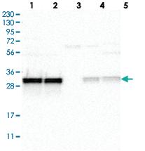 Anti-MRPL45 Rabbit Polyclonal Antibody