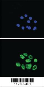 Anti-EXO1 Rabbit Polyclonal Antibody