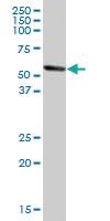 Anti-ALDH1A1 Mouse Polyclonal Antibody