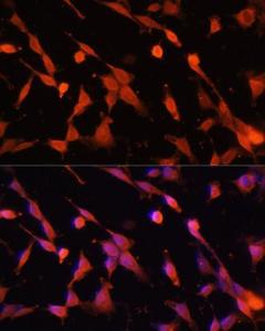 Immunofluorescence analysis of NIH/3T3 cells using Anti-Caspase-3 Antibody (A93186) at a dilution of 1:100. DAPI was used to stain the cell nuclei (blue)