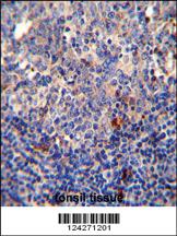 Anti-BCL10 Rabbit Polyclonal Antibody