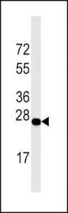 Anti-DDIT4 Rabbit Polyclonal Antibody (HRP (Horseradish Peroxidase))