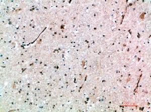 Immunohistochemical analysis of paraffin-embedded human brain using Anti-AVPR1B Antibody