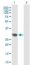 Anti-RPAIN Mouse Polyclonal Antibody