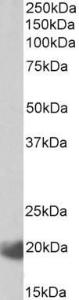 Anti-IL17C antibody