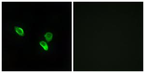 Immunofluorescence analysis of MCF7 cells using Anti-MRPS18C Antibody. The right hand panel represents a negative control, where the antibody was pre-incubated with the immunising peptide