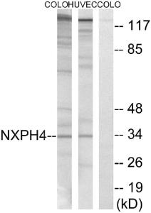 Western blot analysis of lysates from COLO and HUVEC cells using Anti-NXPH4 Antibody. The right hand lane represents a negative control, where the antibody is blocked by the immunising peptide