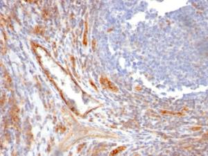 Immunohistochemical analysis of formalin-fixed, paraffin-embedded human tonsil using Anti-CD31 Antibody [C31.10]