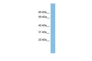 Anti-FBXL4 Rabbit Polyclonal Antibody