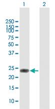 Anti-VEGFB Rabbit Polyclonal Antibody