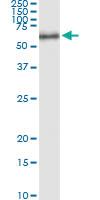 Anti-LPL Polyclonal Antibody Pair