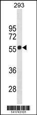 Anti-CNR1 Rabbit Polyclonal Antibody (FITC (Fluorescein Isothiocyanate))