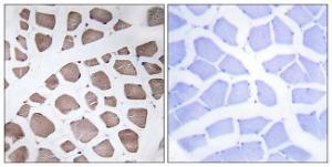 Immunohistochemical analysis of paraffin-embedded human skeletal muscle tissue using Anti-MRPS18C Antibody. The right hand panel represents a negative control, where the antibody was pre-incubated with the immunising peptide