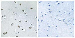 Immunohistochemical analysis of paraffin-embedded human brain tissue using Anti-NXPH4 Antibody. The right hand panel represents a negative control, where the antibody was pre-incubated with the immunising peptide