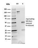 SDS-PAGE analysis of Anti-Calretinin Antibody [CALB2/2603] under non-reduced and reduced conditions; showing intact IgG and intact heavy and light chains, respectively. SDS-PAGE analysis confirms the integrity and purity of the Antibody