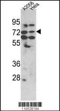 Anti-HSPA8 Rabbit Polyclonal Antibody