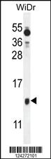 Anti-BEX1 Rabbit Polyclonal Antibody