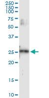 Anti-VEGFB Rabbit Polyclonal Antibody