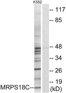 Western blot analysis of lysates from K562 cells using Anti-MRPS18C Antibody. The right hand lane represents a negative control, where the antibody is blocked by the immunising peptide