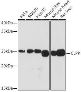 Western blot analysis of extracts of various cell lines, using Anti-CLPP Antibody [ARC1929] (A306224) at 1:1,000 dilution. The secondary antibody was Goat Anti-Rabbit IgG H&L Antibody (HRP) at 1:10,000 dilution.