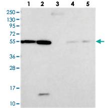 Anti-DEPDC4 Rabbit Polyclonal Antibody