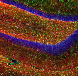 Immunofluorescent analysis of mouse hippocampus section stained using Anti-Myelin Basic Protein Antibody (A270546), at a dilution of 1:5,000, in re