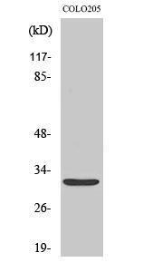 Western blot analysis of various cells using Anti-NXPH4 Antibody