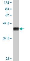 Anti-PDGFC Mouse Polyclonal Antibody