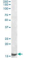 Anti-CST3 Goat Polyclonal Antibody