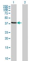 Anti-TSNAXIP1 Mouse Polyclonal Antibody