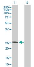 Anti-VEGFB Rabbit Polyclonal Antibody