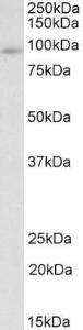 Anti-FYB Antibody (A83463) (0.2 µg/ml) staining of MOLT4 lysate (35 µg protein in RIPA buffer). Primary incubation was 1 hour. Detected by chemiluminescence